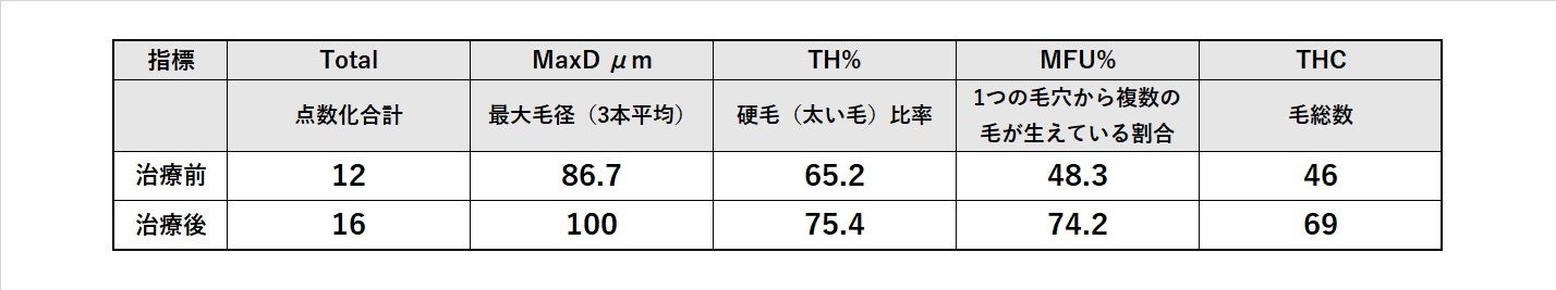 男性型脱毛症（AGA）の治療効果を「毛包単位」で評価する新指標を確立した研究が学術誌に掲載